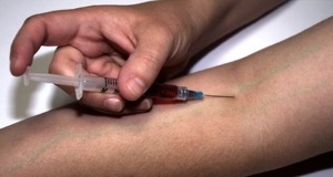 Роспотребнадзор предупредил россиян о вспышке гепатита А в 20 европейских странах