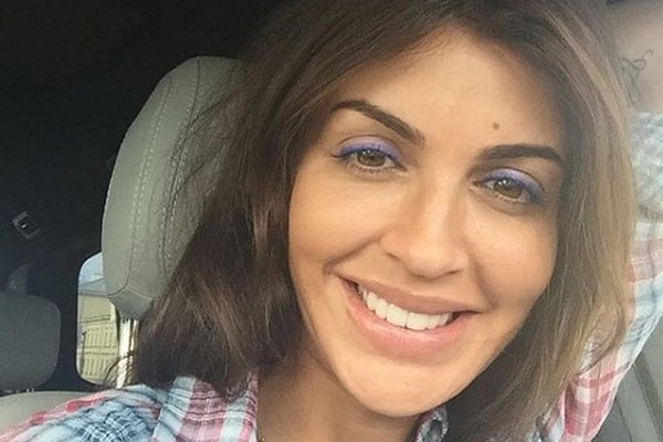 Страдающая аутоиммунным некрозом Алиса Казьмина ужаснула соцсети снимком с открытым лицом